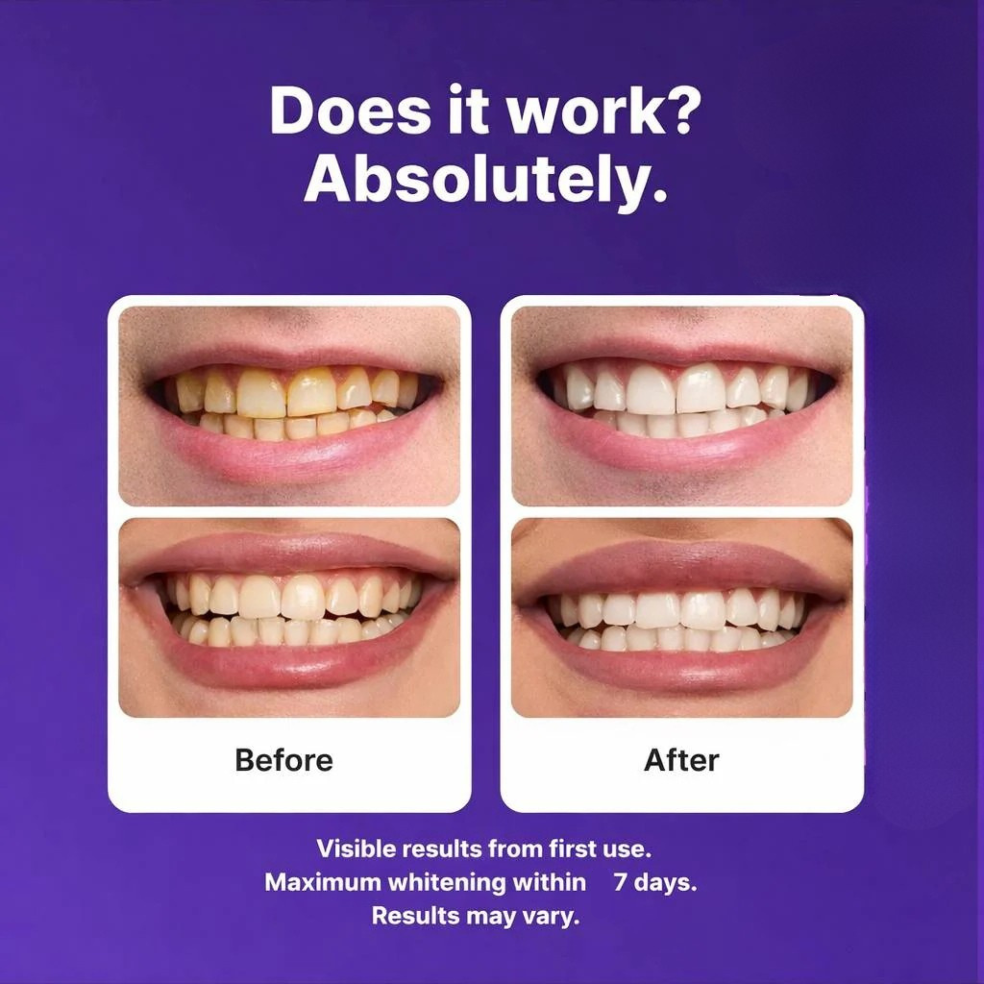 Foxes Purple Teeth Whitening Strips™